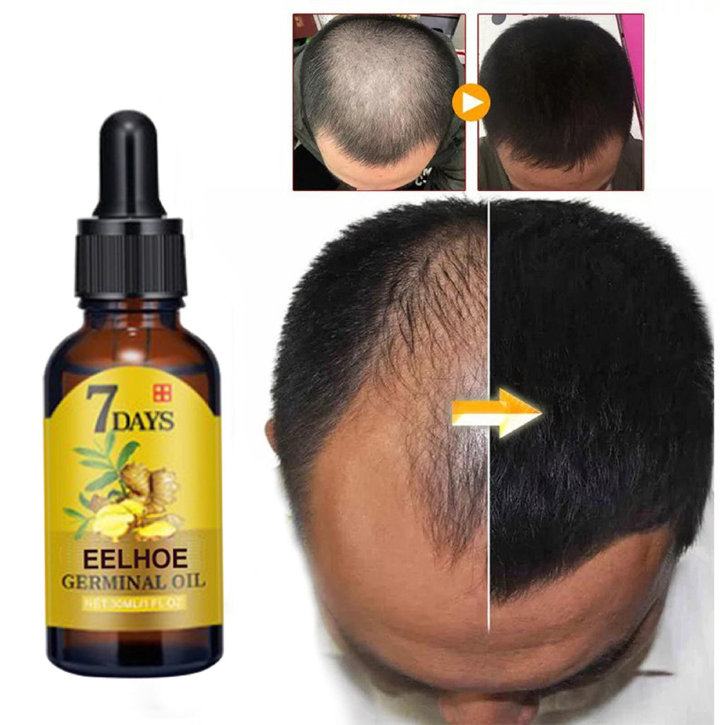 Ginger Hair Care Solution For Hair Nourishing And Moisturizing